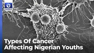 Five Major Kinds Of Cancer That Affect Adolescents & Young Adults In Nigeria