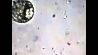 Killing bacteria