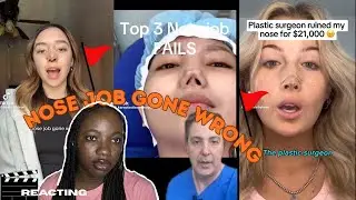 Nose Jobs Gone Wrong  Shocking Plastic Surgery Re