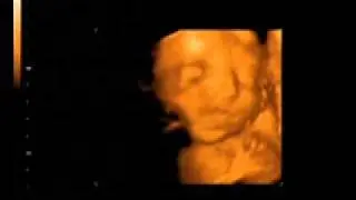 Baby Jemmye 28 Weeks Part 1