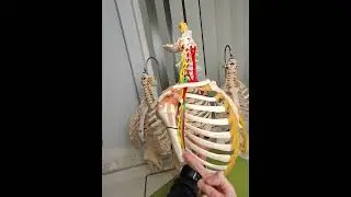 Find the M in the brachial plexus.