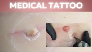 How we tattoo a 3D Areola Nipple | Single nipple tattoo education 