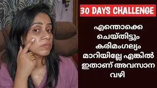 30 DAYS CHALLENGE/If pigmentation doesn't change even after doing this, it will never change #mel...
