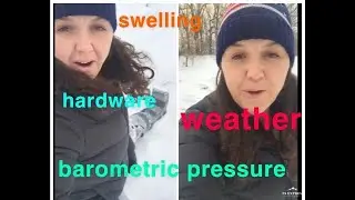 Does weather affect the hardware in my body?