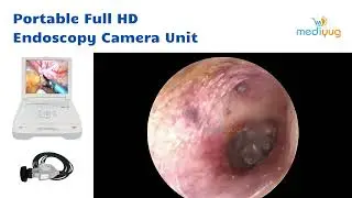 Portable Full HD Endoscopy Camera Unit | Mediyug Services | @MediYug