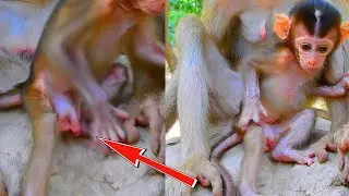 S..a..d Moment! Serious Problem On Baby Kenzo's One Foot Is Not Better Yet...!