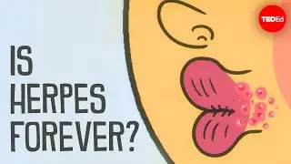 What causes herpes, and how can you treat it? - Christine Johnston