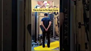 This is how to Fix Neck Hump | 𝐀𝐩 𝐊𝐚 𝐏𝐡𝐲𝐬𝐢𝐨 | 𝐃𝐫. 𝐀𝐌𝐏𝐓