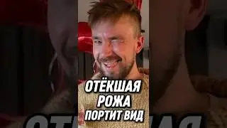 🔥 Ужас старения Петрова: лысый, постарел на фото 2023&ndash;2025, comeback после выгорания  😱