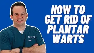 How to get rid of plantar warts | Dr. Nick Campitelli