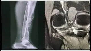 MSK spot with answers and last two cases quiz