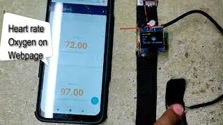 IoT based Sleep Apnea detection and Health Monitoring smart Band