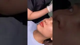 Kỹ thuật phun m&ocirc;i kh&ocirc;ng sưng nano candylip  Phoenix Beauty Center  Hotline: 0903894466