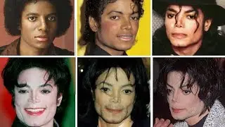 Celebrity plastic surgery disasters | Michael Jackson and many more celebrity 🥲