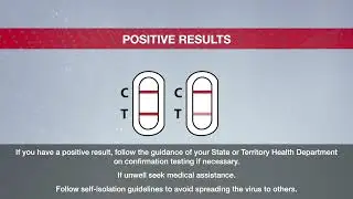 Maccura (Nasal) Rapid Antigen Test - Self Test