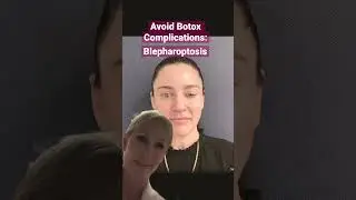 Avoid Botox Complications #botox #shorts