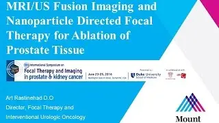 Focal Therapy: Gold Nano-Particle Directed Laser Ablation using MR US Fusion Guidance