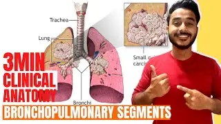 bronchopulmonary segments clinical anatomy | clinical anatomy of lungs anatomy