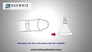 APPLICATION FOR UNCIRCUMCISED MALES - - GEEWHIZ&reg; External Male Catheter