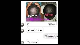 Experiencing Hair Loss? WE CAN HELP! - KT Beauty Boom
