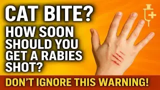 What To Do If a Cat Bites You &mdash; Rabies Vaccine Timing Explained