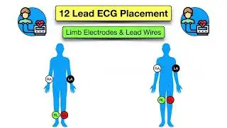 12 Lead ECG Placement MADE EASY [EMT, Nursing, Paramedic] #ecg #nursing
