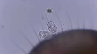 Sessilid ciliates growing epizootically on an ostracod