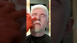 Life-changing makeover for albino man #shorts