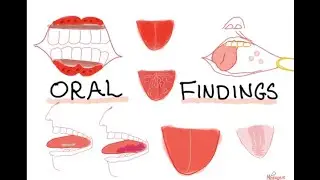 Oral Lesions & Associated Diseases
