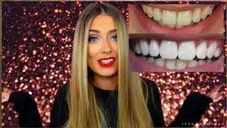 How l Whitened My Teeth at Home l Danielle Mansutti