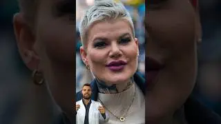 Melanie M&uuml;ller: Vorher/Nachher #melaniem&uuml;ller #vorhernachher #beautydoc #doc