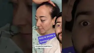AS&Iacute; SE HACE LA REDUCCI&Oacute;N DE FRENTE
