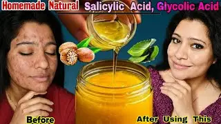 Homemade Natural AHA & BHA(Salicylic Acid, Glycolic Acid)To Make Skin Youthful,Glowing।Garima Singh