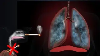 Effects of Smoking on Your Body and Lungs (3D Animation)