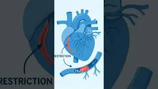 TMT Test Explained | What Is a Treadmill Test & Why It&rsquo;s Done | Healocity