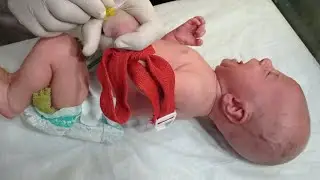 How to Receive a Newborn from Labor Room | IV Line & NICU Initial Care