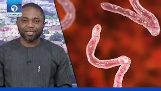 Why Deworming Is Necessary For Your Child - Family Physician | Health Matters