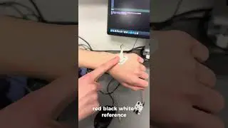 How to detect flexed muscle using EMG and RPI Pico