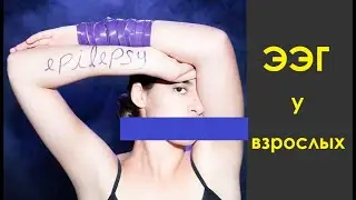 ЭЭГ головного мозга у взрослых. Как подготовиться и что делать при записи электроэнцефалограммы(ЭЭГ)