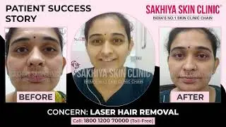 Expert Laser Hair Removal Results | Full Body Treatment | Sakhiya Skin Clinic