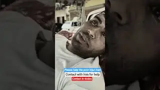 Accident Very poor young man #help #poor #accident #young #needy #pakistan #pashto #atta
