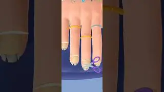 ASMR Ingrow nail removal #asmr #trend #trending #viral #asmrgaming @MrBeast