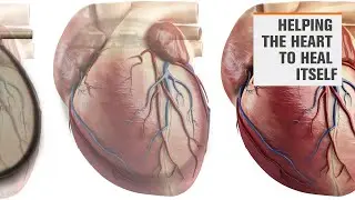 Helping the heart to heal itself