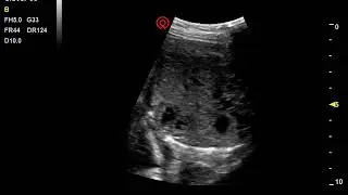 Fetal cardiac by Clover 60