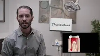 Cardinal Dental: Root Canal Therapy in La Mesa, CA