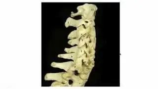 Radiographic Anatomy of the Cervical Spine (Quick Version)