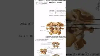 Resumo de coluna #medico #anatomia #anatomy #ortopedia #sbot #teot