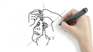 How to Apply Eye Drops