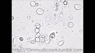 Trichomonas vaginalis
