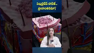 When Cellulitis Gets Infected? How Serious It Can Be? | KBK Hospitals